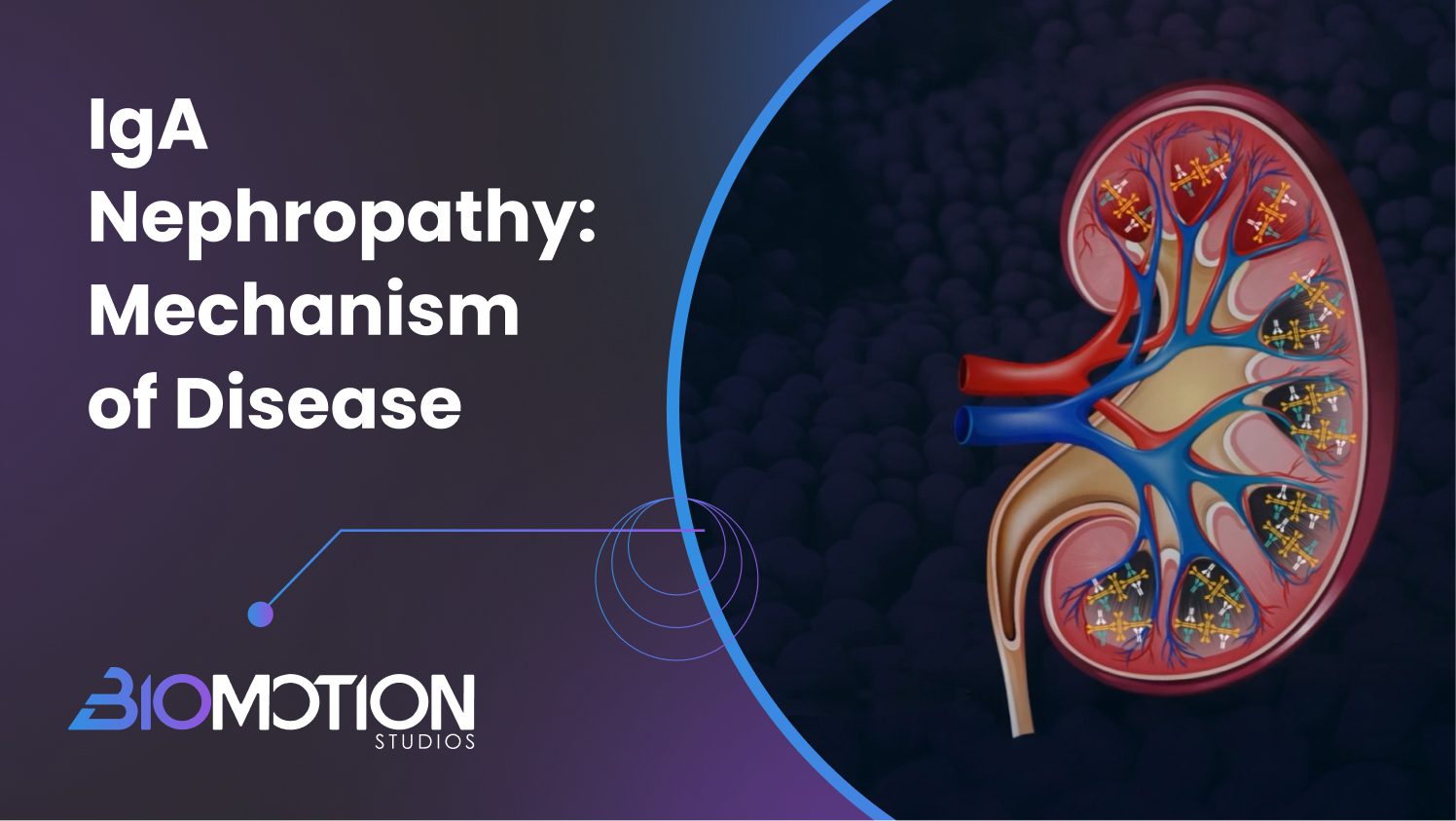 Protected: IgA Nephropathy